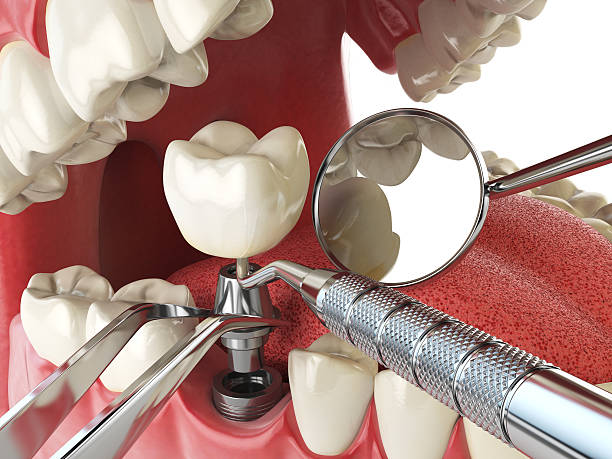 Best Pediatric Emergency Dentist in Harper Woods, MI